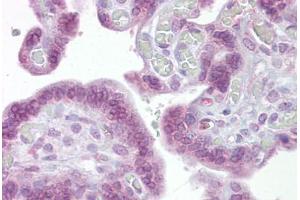 Anti-IRF6 antibody IHC staining of human placenta.