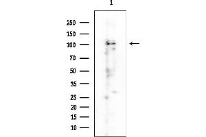 Western blot analysis of lysates from Rat brain, using CTNND1 Mouse Monoclonal Antibody at 1/1000 dilution.