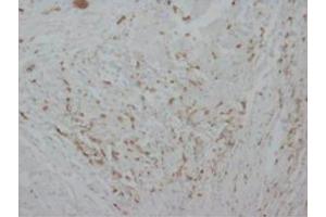 Immunohistochemical analysis of paraffin embedded Human tissue sections (ovary) using Myeloperoxidase antibody (Myeloperoxidase anticorps  (C-Term))