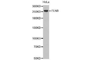 Western Blotting (WB) image for anti-Filamin B, beta (FLNB) (AA 1686-1785) antibody (ABIN6219554) (FLNB anticorps  (AA 1686-1785))