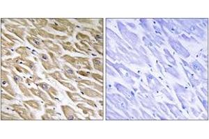 Immunohistochemistry analysis of paraffin-embedded human heart tissue, using MRPL39 Antibody.