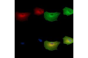ABIN7097065 and ABIN7101132 staining  cells by IF/ICC. (GGN anticorps)
