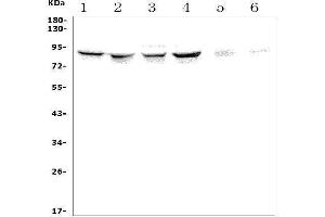Western blot analysis of ALDH18A1 using anti-ALDH18A1 antibody (ABIN7599110).