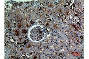 Immunohistochemistry (IHC) analysis of paraffin-embedded Human Kidney, antibody was diluted at 1:100. (Catalase anticorps  (C-Term))