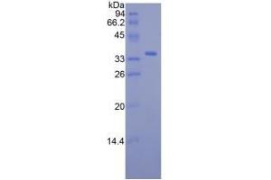SDS-PAGE analysis of Mouse RBP3 Protein.
