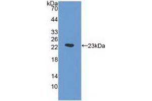 Detection of Recombinant a1AGP, Human using Monoclonal Antibody to Alpha-1-Acid Glycoprotein (a1AGP)