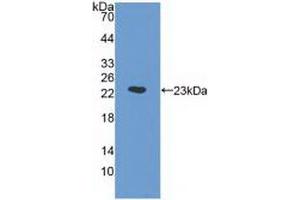 Detection of Recombinant a1AGP, Human using Monoclonal Antibody to Alpha-1-Acid Glycoprotein (a1AGP) (ORM1 anticorps  (AA 19-201))
