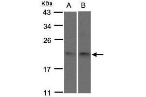 WB Image Sample(30 μg of whole cell lysate) A:293T B:H1299 15% SDS PAGE antibody diluted at 1:1500 (SNX12 anticorps  (C-Term))