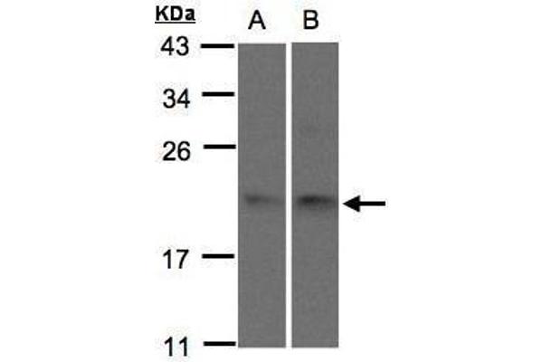 SNX12 anticorps  (C-Term)