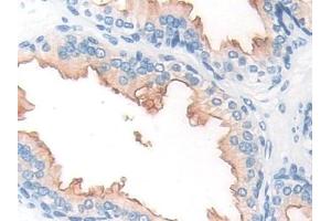 Detection of PMSA in Human Prostate Tissue using Polyclonal Antibody to Prostate-specific Membrane Antigen (PMSA) (PSMA anticorps  (AA 274-587))
