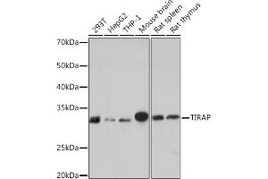 Western blot analysis of extracts of various cell lines, using TIRAP Rabbit mAb (ABIN7270842) at 1:1000 dilution.