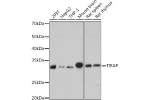 Western blot analysis of extracts of various cell lines, using TIRAP Rabbit mAb (ABIN7270842) at 1:1000 dilution. (TIRAP anticorps)