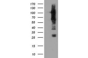 Western Blotting (WB) image for anti-Transforming, Acidic Coiled-Coil Containing Protein 3 (TACC3) antibody (ABIN1498101)