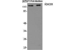 Western Blot (WB) analysis of specific cells using HDAC5/9 Polyclonal Antibody. (HDAC5/9 (Ser1177) anticorps)