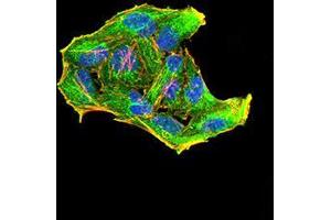 Immunofluorescence analysis of Hela cells using Rab6b mouse mAb (green).