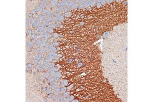 Immunohistochemistry of paraffin-embedded mouse brain using PRKB Rabbit mAb (ABIN7269663) at dilution of 1:100 (40x lens).