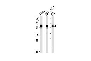 Western blot analysis in Hela,SH-SY5Y,rat C6 cell line lysates (35ug/lane). (GOPC anticorps)