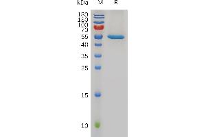 Human Protein, hFc Tag on SDS-PAGE under reducing condition.