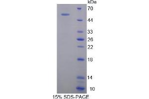 Image no. 1 for Oncostatin M Receptor (OSMR) (AA 410-652) protein (His tag,GST tag) (ABIN4988843) (Oncostatin M Receptor Protein (OSMR) (AA 410-652) (His tag,GST tag))