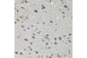 Immunohistochemistry of paraffin-embedded mouse brain using PPID Antibody.
