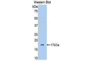 Western Blotting (WB) image for anti-Complement Factor B (CFB) (AA 477-600) antibody (ABIN1858375)