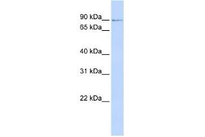 WB Suggested Anti-ZNF263 Antibody Titration: 0. (ZNF263 anticorps  (N-Term))