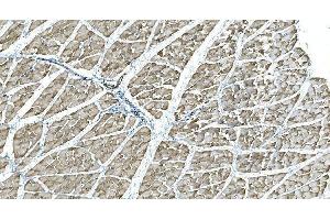 IHC analysis of IDH2 using anti-IDH2 antibody (ABIN7602787).