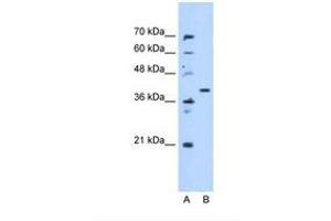 Image no. 1 for anti-Enoyl CoA Hydratase Domain Containing 3 (ECHDC3) (AA 71-120) antibody (ABIN341636) (ECHDC3 anticorps  (AA 71-120))