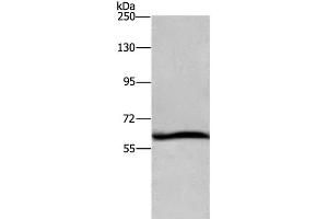 Western Blot analysis of Hela cell using DCP1A Polyclonal Antibody at dilution of 1:1100 (DCP1A anticorps)