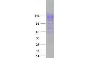 Validation with Western Blot