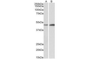 AP23754PU-N NDRG2 antibody staining of of Mouse (A) and Rat (B) Brain lysates at 0. (NDRG2 anticorps  (N-Term))