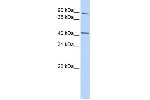 WB Suggested Anti-FECH Antibody Titration:  0. (FECH anticorps  (Middle Region))