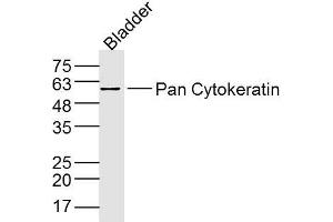 Mouse Bladder lysates probed with Pan Cytokeratin Polyclonal Antibody, Unconjugated  at 1:300 dilution and 4˚C overnight incubation.