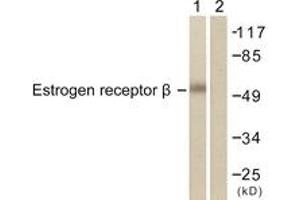 Western blot analysis of extracts from HeLa cells, treated with EGF 200ng/ml 30', using Estrogen Receptor-beta (Ab-105) Antibody. (ESR2 anticorps  (AA 71-120))