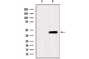 Western blot analysis of extracts from Mouse brain, using ASBT Antibody. (SLC10A2 anticorps  (C-Term))