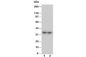 Western blot testing of Aquaporin 8 antibody and Lane 1:  SW620 (Aquaporin 8 anticorps  (N-Term))