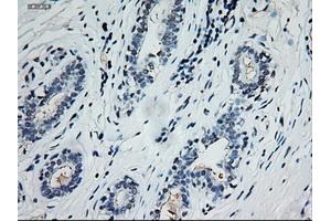 Immunohistochemical staining of paraffin-embedded breast using anti-EpCAM (ABIN2452677) mouse monoclonal antibody. (EpCAM anticorps  (AA 24-265))