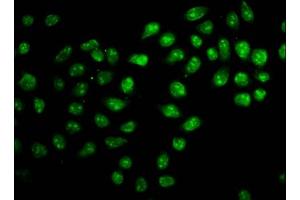 Immunofluorescence staining of Hela cells with ABIN7176167 at 1:166, counter-stained with DAPI. (ZNF224 anticorps  (AA 477-607))