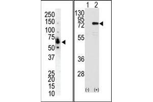 (LEFT)Western blot analysis of anti-PKC eta N-term Pab in NCI-H460 cell lysate. (PKC eta anticorps  (N-Term))