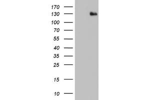 Western Blotting (WB) image for anti-ADAM Metallopeptidase with Thrombospondin Type 1 Motif, 1 (ADAMTS1) (AA 412-644) antibody (ABIN2715715) (ADAMTS1 anticorps  (AA 412-644))