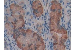 Detection of FGg in Human Stomach Tissue using Polyclonal Antibody to Fibrinogen Gamma (FGg)