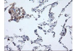 Image no. 12 for anti-Amyloid beta (A4) Precursor Protein (APP) antibody (ABIN1496885) (APP anticorps)