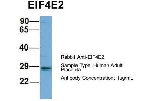 Host: Rabbit  Target Name: EIF4E2  Sample Tissue: Human Adult Placenta  Antibody Dilution: 1. (EIF4E2 anticorps  (N-Term))