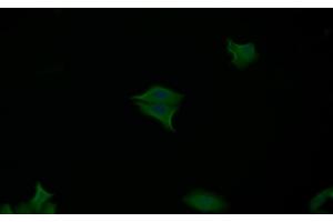 Detection of CASP7 in Human MCF7 cell using Polyclonal Antibody to Caspase 7 (CASP7) (Caspase 7 anticorps  (AA 207-303))