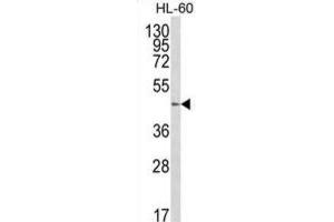 Western Blotting (WB) image for anti-UDP-Gal:betaGlcNAc beta 1,4 Galactosyltransferase, Polypeptide 1 (B4GALT1) antibody (ABIN3003951)