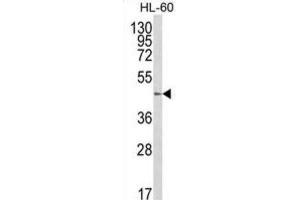 Western Blotting (WB) image for anti-UDP-Gal:betaGlcNAc beta 1,4 Galactosyltransferase, Polypeptide 1 (B4GALT1) antibody (ABIN3003951) (B4GALT1 anticorps)