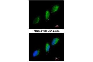 ICC/IF Image Immunofluorescence analysis of paraformaldehyde-fixed HeLa, using TYK2, antibody at 1:200 dilution.