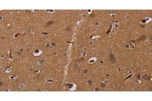 Immunohistochemistry of paraffin-embedded Human brain using MOB1A Polyclonal Antibody at dilution of 1:30 (MOB1A anticorps)