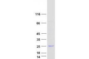 Validation with Western Blot