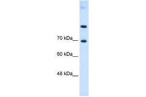 WB Suggested Anti-SLC7A4 Antibody Titration:  0. (SLC7A4 anticorps  (Middle Region))